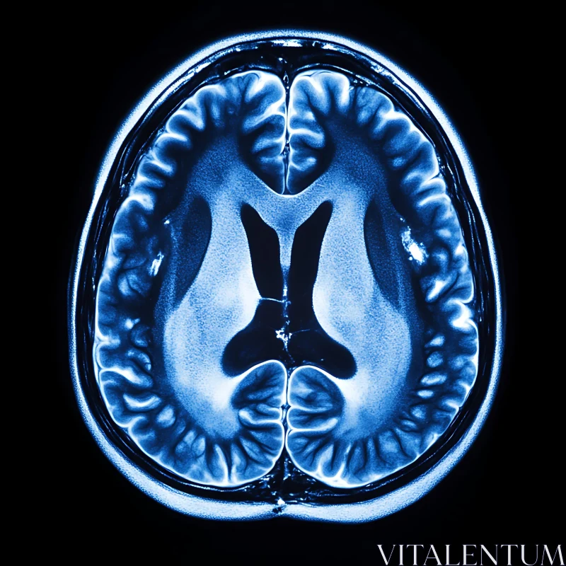 AI ART Blue-Toned Brain MRI Axial View